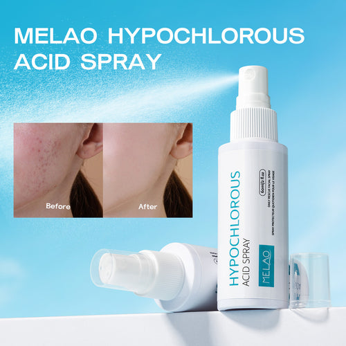 MELAO Hypochlorous Acid Facial Spray: Soothing Anti-Acne Face Mist for All Skin Types | 80ml